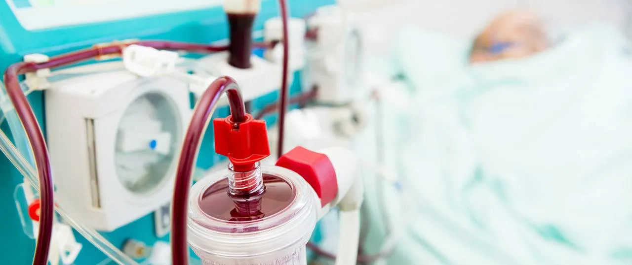 Nefropatia Diabética