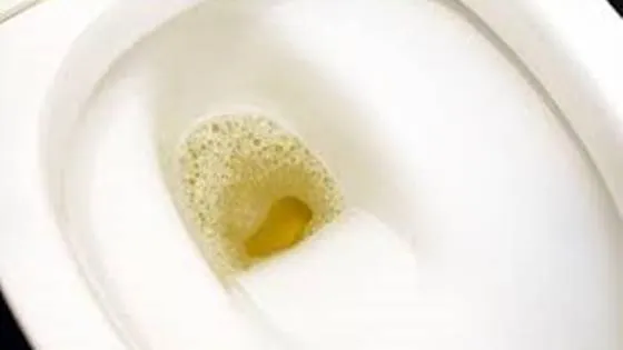 nefropatia diabética - urina espumosa